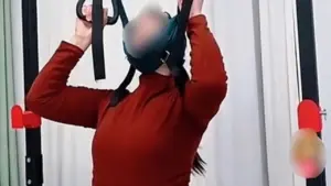 Bác sĩ: Tự 'treo cổ' chữa thoát vị đĩa đệm, coi chừng tổn thương tủy