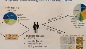 Coi chừng nhầm tưởng ung thư phổi với bệnh hô hấp